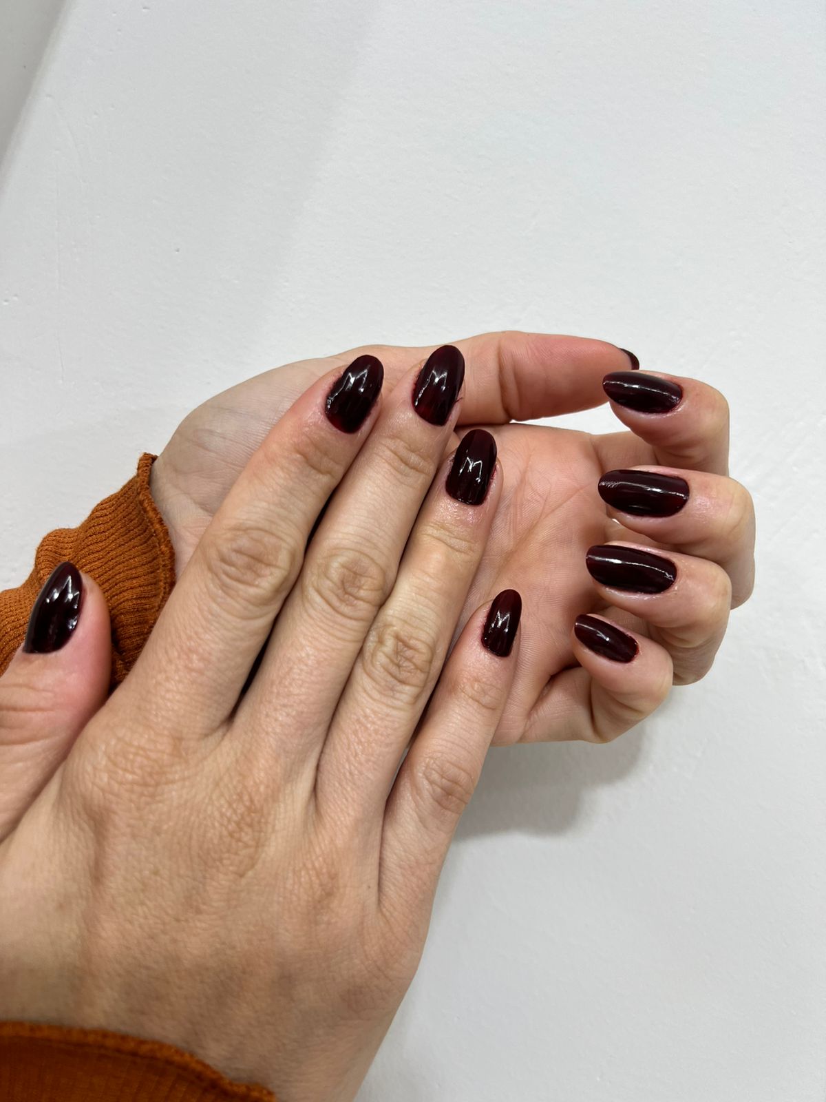 Unhas